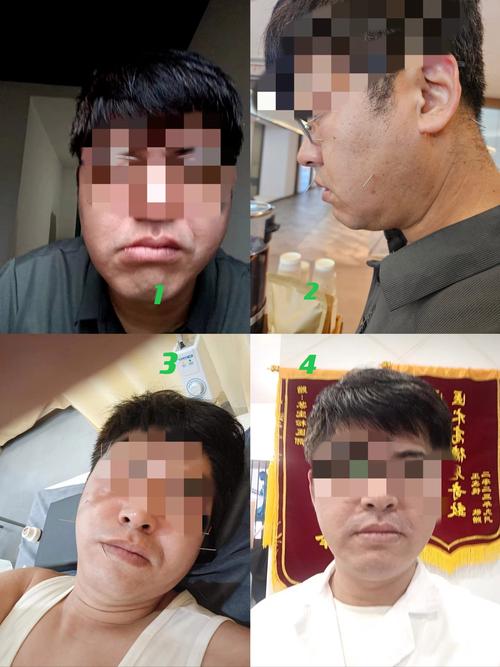新2025澳门天天开好彩和男子吹一夜空调面瘫与男子吹一夜空调面瘫视频