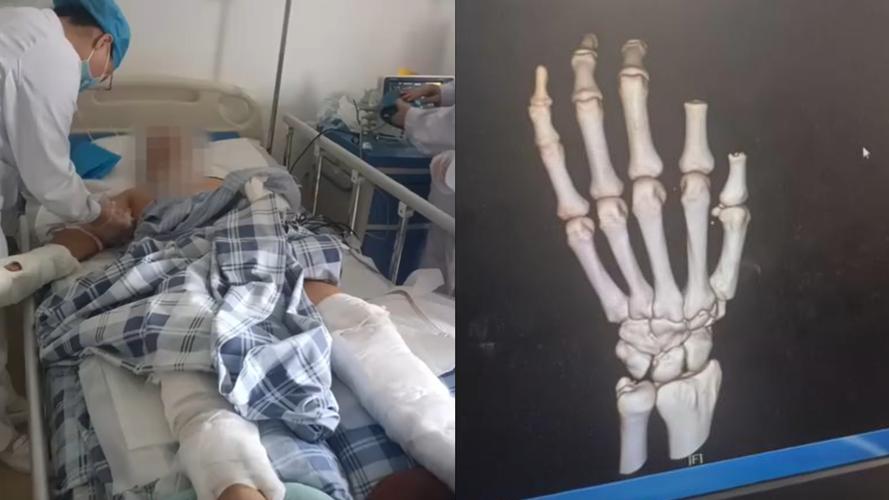 新澳今晚特9点30开什么和男子持菜刀砍伤同学与一男子持菜刀砍学生